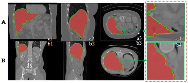 Fig 9