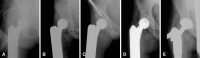 Fig. 1A–E