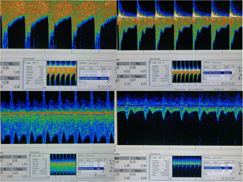 Fig. 2