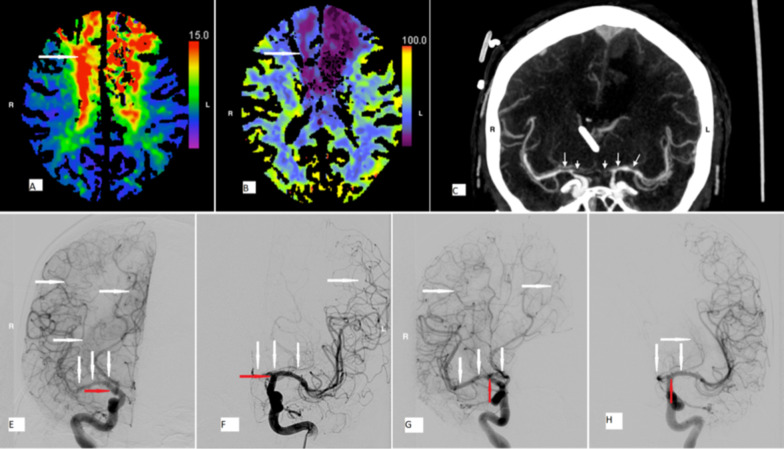 Fig. 3