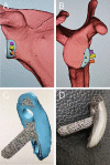 Fig. 2