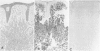 199