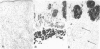 200