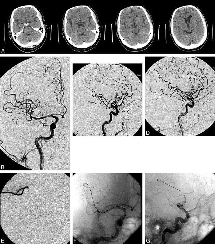 Fig 2.