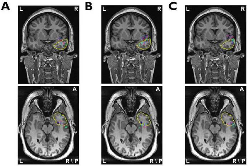 Fig.2