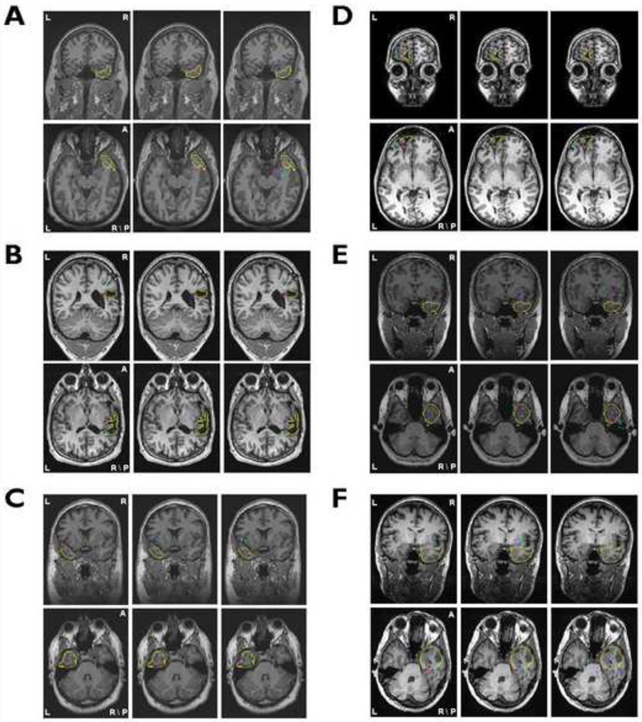 Fig.3