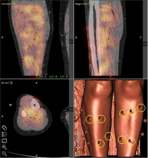 Figure 12