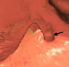 Figure 2e: