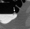 Figure 2d: