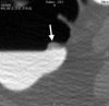 Figure 2a: