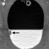 Figure 1d: