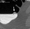 Figure 2c: