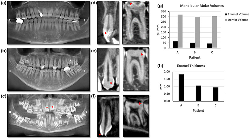 FIGURE 3