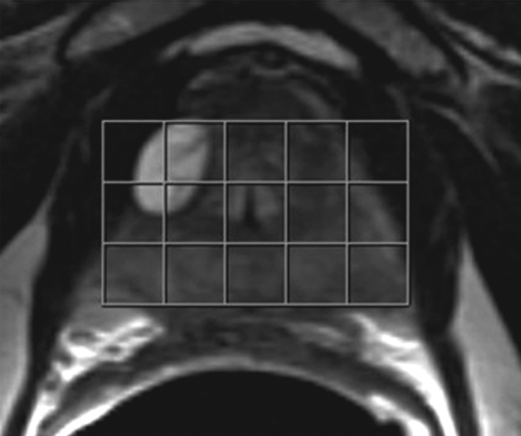 Figure 2a: