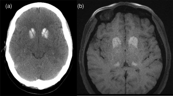 Fig 1.