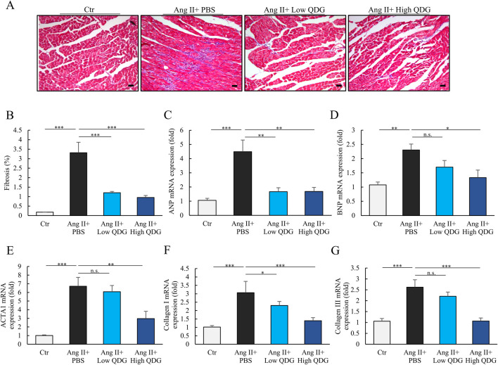 Histological and bar chart analysis of cardiac tissue under different treatments. Panel A shows microscopic images of cardiac tissue with varying degrees of fibrosis. Panels B to G display bar charts comparing fibrosis percentage, ANP, BNP, ACTA1, Collagen I, and Collagen III mRNA expressions across control, Ang II plus PBS, low QDG, and high QDG treatments. Significant differences are indicated with asterisks, with notable changes in fibrosis and gene expression between the groups.