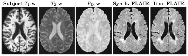 Fig. 2