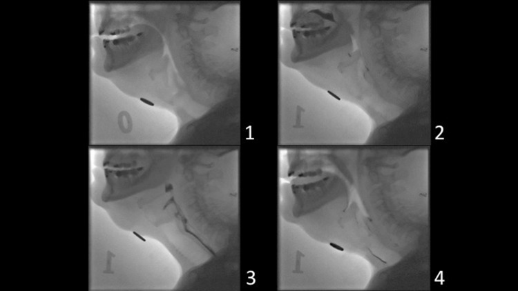 Fig. 1