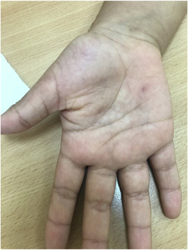 Fig 3
