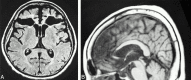 <sc>fig</sc> 1.