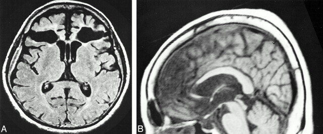 fig 1.