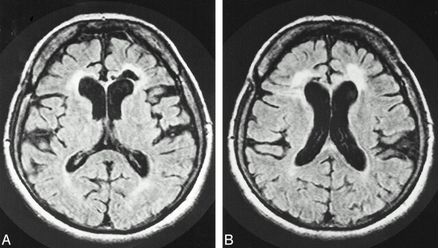 fig 3.