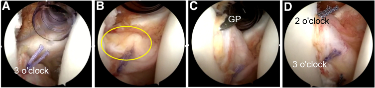 Fig 10