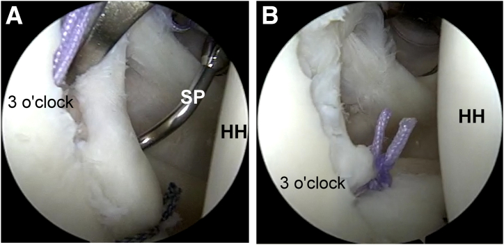 Fig 7