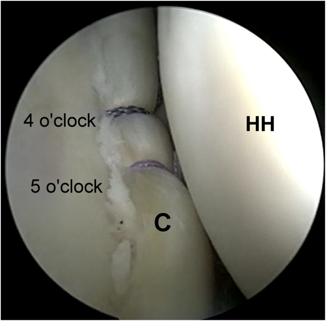 Fig 5