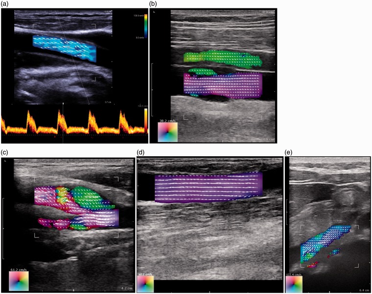 Figure 4