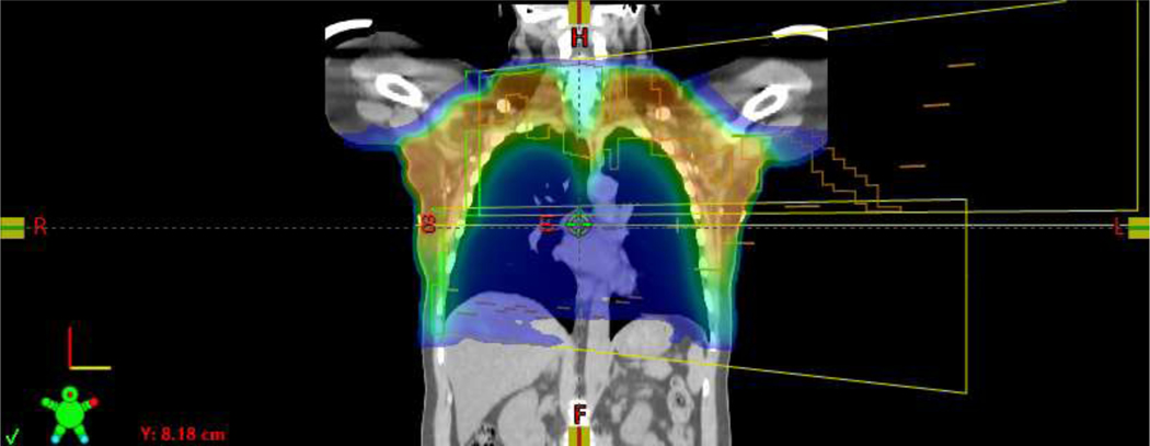 Figure 1D.