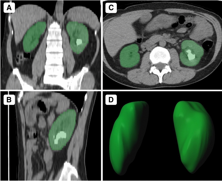 Fig. 2