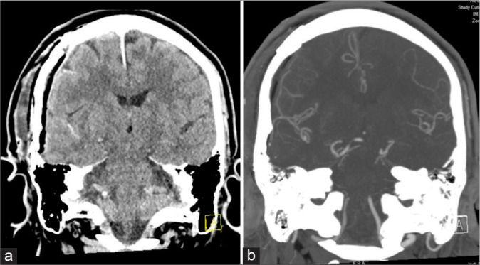 Figure 3: