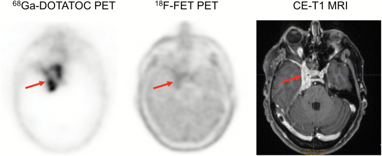 Fig. 6