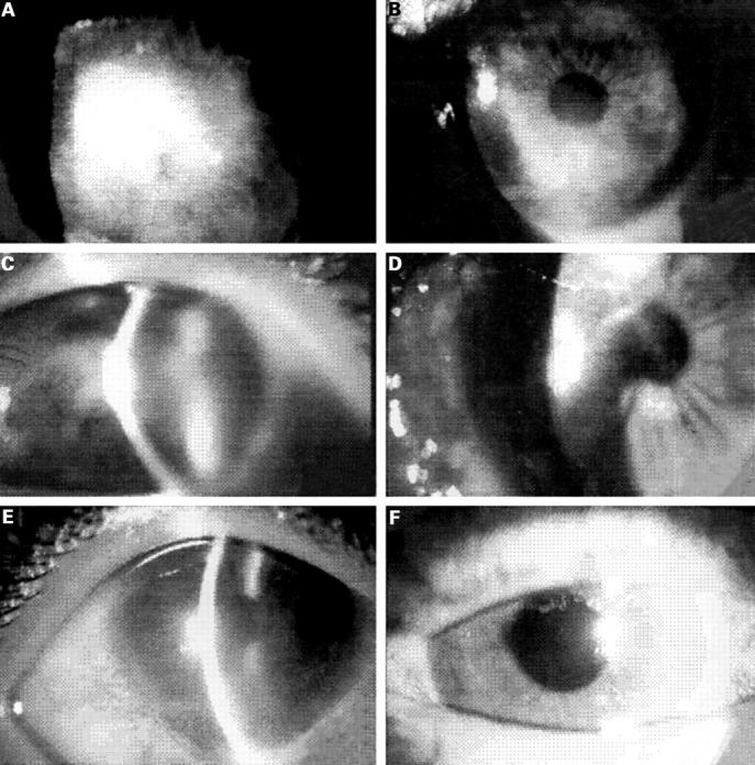 Figure 1  