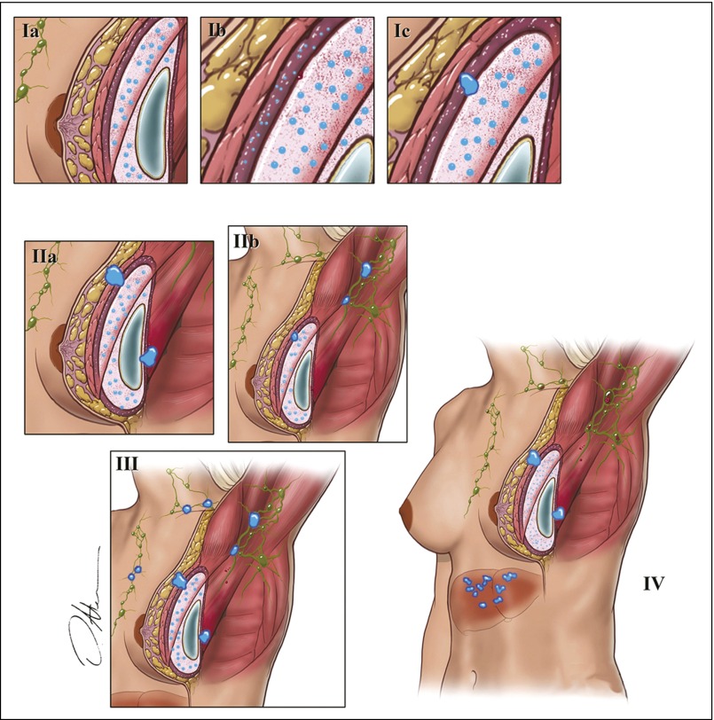 Fig 2.