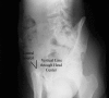 Fig. 12