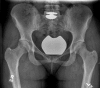 Fig. 15-A Fig. 15-B