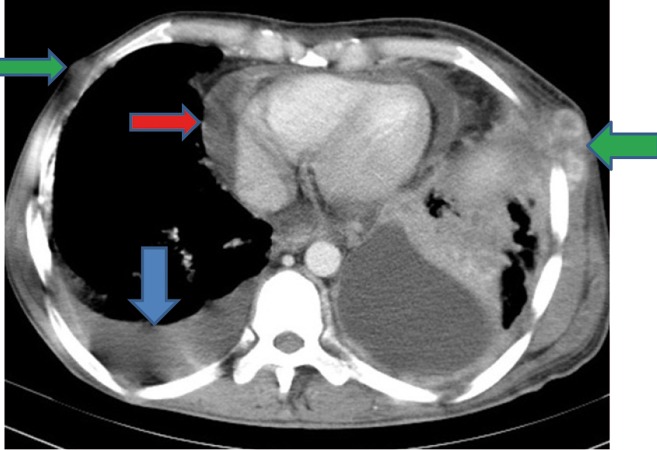 Figure 1C