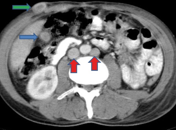 Figure 1J