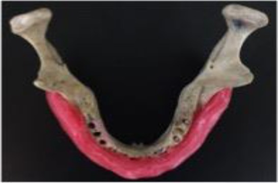 Fig. 1: