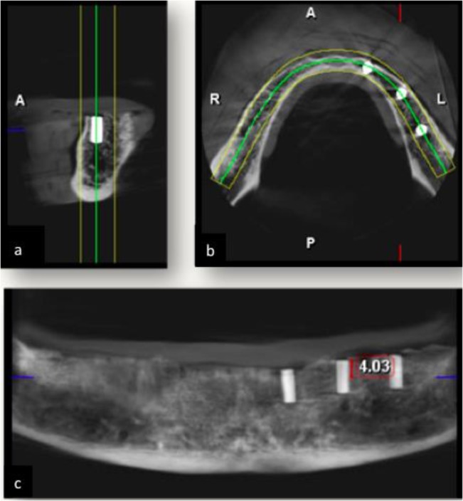 Fig. 3: