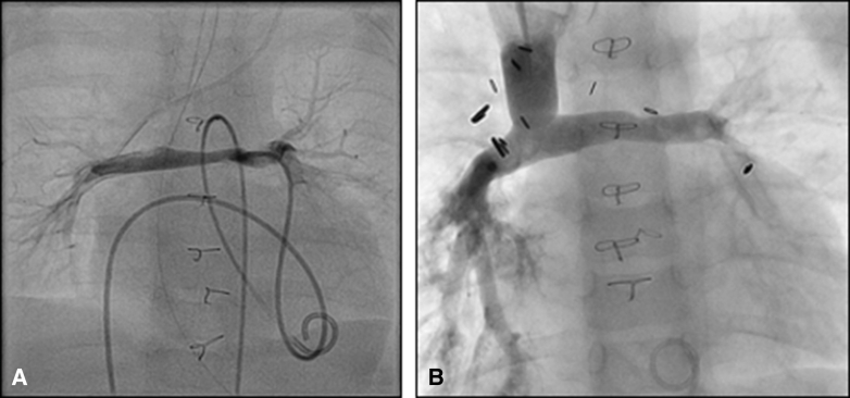 Figure 4