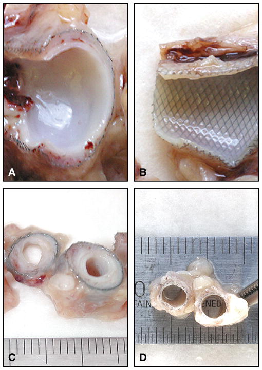 Figure 15