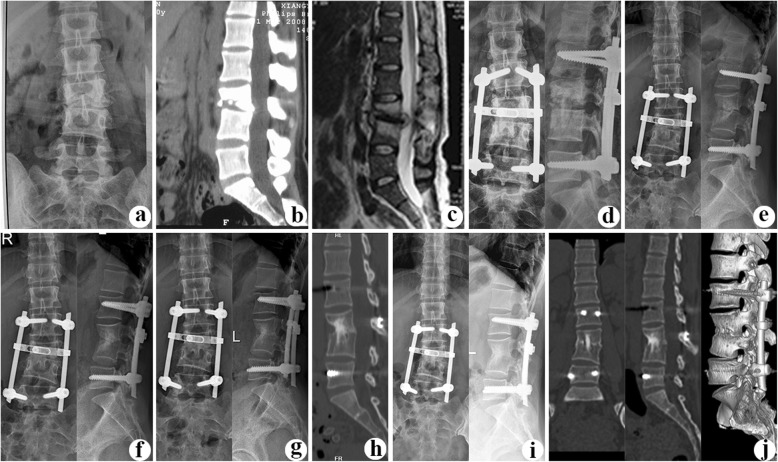 Fig.3