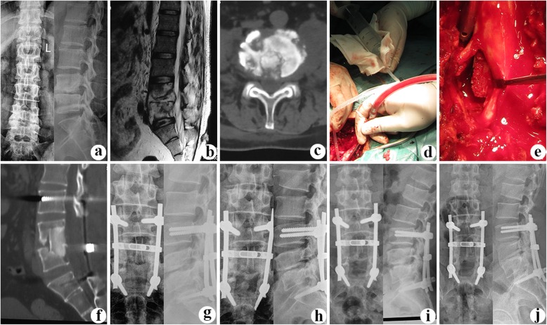 Fig.1