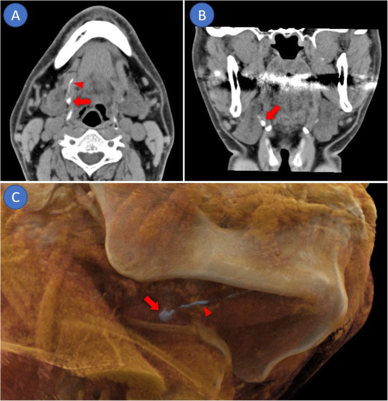 Fig. 1