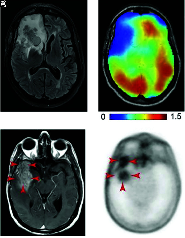 FIG 2.