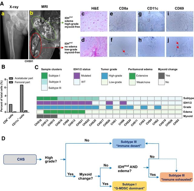 Figure 5. Biomarkers from genetic events and clinical features were integrated to help immune classification of CHS. A and B, A CHS case with 2 distinct parts of the tumor, one in the pelvis and one in the femur. The green area was high-grade tumor with significant peritumoral edema, while the red area was low-grade tumor without peritumoral edema or myxoid change (A). Pathologic examination showing the cell morphology by H&E staining and immune-cell distribution by IHC. CD69 was used as activation marker. Red arrow indicates positive cells. The number of intratumoral immune cells were quantified by flow cytometry (B). C, Biomarkers were integrated to show their potential associations with the immune subtypes of tumor. D, Flow chart to help determine the immune subtypes of CHS.