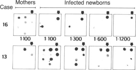 graphic file with name pnas01032-0475-a.jpg